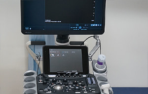 超音波検査（エコー）